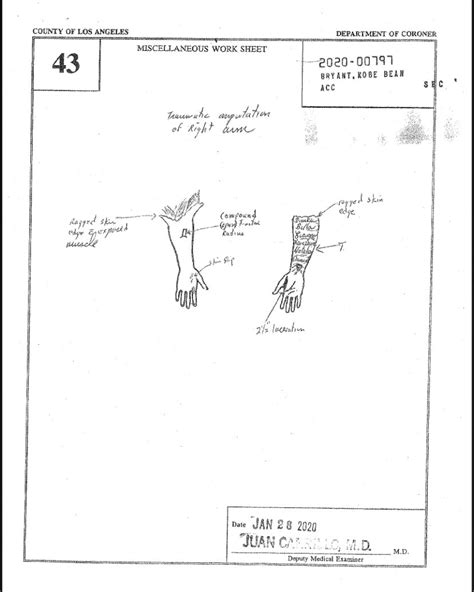 kobe autopsy gigi|Kobe Crash Autopsy Reports : r/CrimeScene